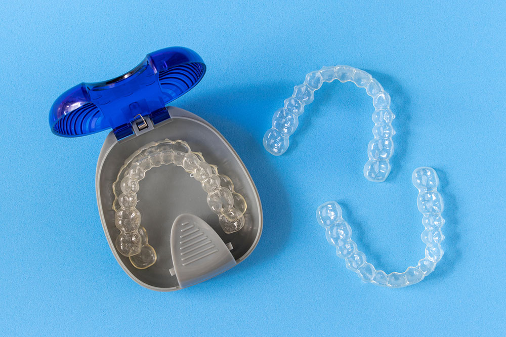 6 Reasons Why Clear Braces are Better Than Traditional Braces